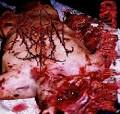 Mutilated Corpses (CAUTION - VERY GRAPHIC)