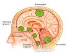 of skull base <b>meningiomas</b>