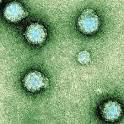 Chikungunya - Mosquito Bites Aedes Aegypti - Causes Symptoms ...