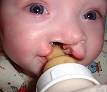220px-Cleft_Nurser_Mead_ ...