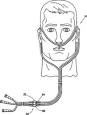 Cannula - Wikipedia, the free encyclopedia