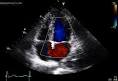 Echocardiogram at Children's Heart Specialists PSC