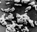 Q-Fever(Coxiella burnetii) | MEDICAL PPTX