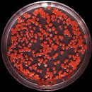 called <b>Serratia marcescens</b>