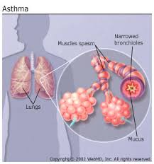 Hidden Problem behind Asthma