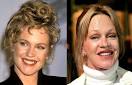 10 Worst Celebrity Plastic Surgeries Botox Jobs Lists That