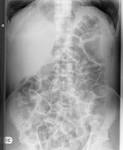 Radiology Quiz 6214 | Radiopaedia.