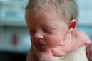 Newborn Baby with Lanugo - What a Newborn Baby Looks Like