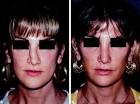 (B) Post-operative view of