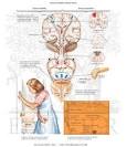 Detrusor Instability and Hyperreflexia - Netter Medical Artwork