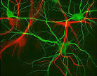 Glial cells can protect or kill neurons in retina | TopNews