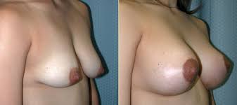 http://t1.gstatic.com/images?q=tbn:ANd9GcS7izep5q2Uy0q0XskEnGpujXvo0LbOAumc9kNf_oeaqCA_Rtz8