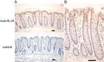 IL-32 synergizes with nucleotide oligomerization domain (NOD) 1 ...