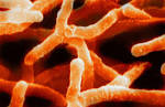 File:Actinomyces israelii.jpg - Wikipedia, the free encyclopedia