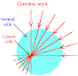 GCSE SCIENCE PHYSICS HIGH SCHOOL - Electromagnetic Waves - Gamma ...