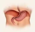 Gastroparesis | ACG Patients