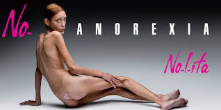 Anorexie - Isabelle Caro