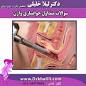 Image result for u202bعمل زيبايي واژن زنانu202c