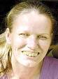 [Woman+bad+teeth]