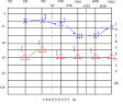 Sensori-Neural <b>Hearing Loss</b>