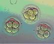 In Vitro Fertilization: IVF : American Pregnancy Association