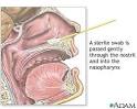 NASOPHARANGEAL SWABS/