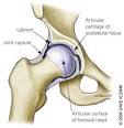 Most frequently <b>hip joint</b> pain