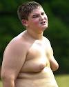 Breast Enlargement in Boys - cause??? | Health Spa Blog
