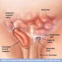 Mayo Clinic medical information and tools for healthy living ...