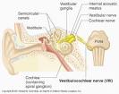 The <b>vestibulocochlear nerve</b> is