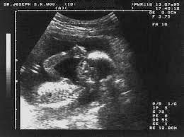 ultrasound2