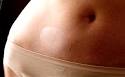 Sexual dysfunction drugs creating a sexual arms race