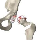ComCare « ANDERSONS LAW BLOG