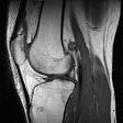 <b>Imaging</b> a <b>risonanza magnetica</b>