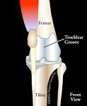 Luxating patella