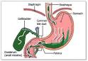 Bile Pictures