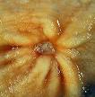 Peptic ulcer - Wikipedia, the free encyclopedia