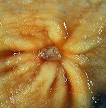  ‏القرحة الهضمية Peptic ulcer Images?q=tbn:ANd9GcSKQDfCS7RZtmrSKkUpug2I6090yRCMVnRByCUl04bHjyv41NHYqz_e5vo