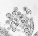 <b>Hantavirus</b> particles (Source: