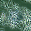 smallpox vaccine « noworldsystem.