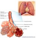 Chronic Obstructive Pulmonary Disease (