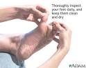 <b>Diabetic foot</b> care
