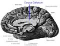 Corpus Callosum
