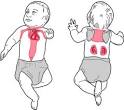 brown fat - definition of brown fat in the Medical dictionary - by ...