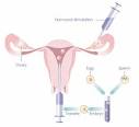 Assisted Reproductive Technology | | Pregnancy Week by Week ...