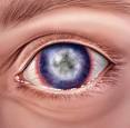 <b>eye</b>-<b>infection</b>-reliable-optics