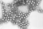 File:Feline calicivirus.jpg - Wikipedia, the free encyclopedia