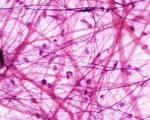 Loose <b>Connective Tissue</b> | histologyolm.