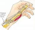 <b>De Quervain's</b> tenosynovitis