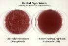 File:<b>Neisseria gonorrhoeae</b> 01.